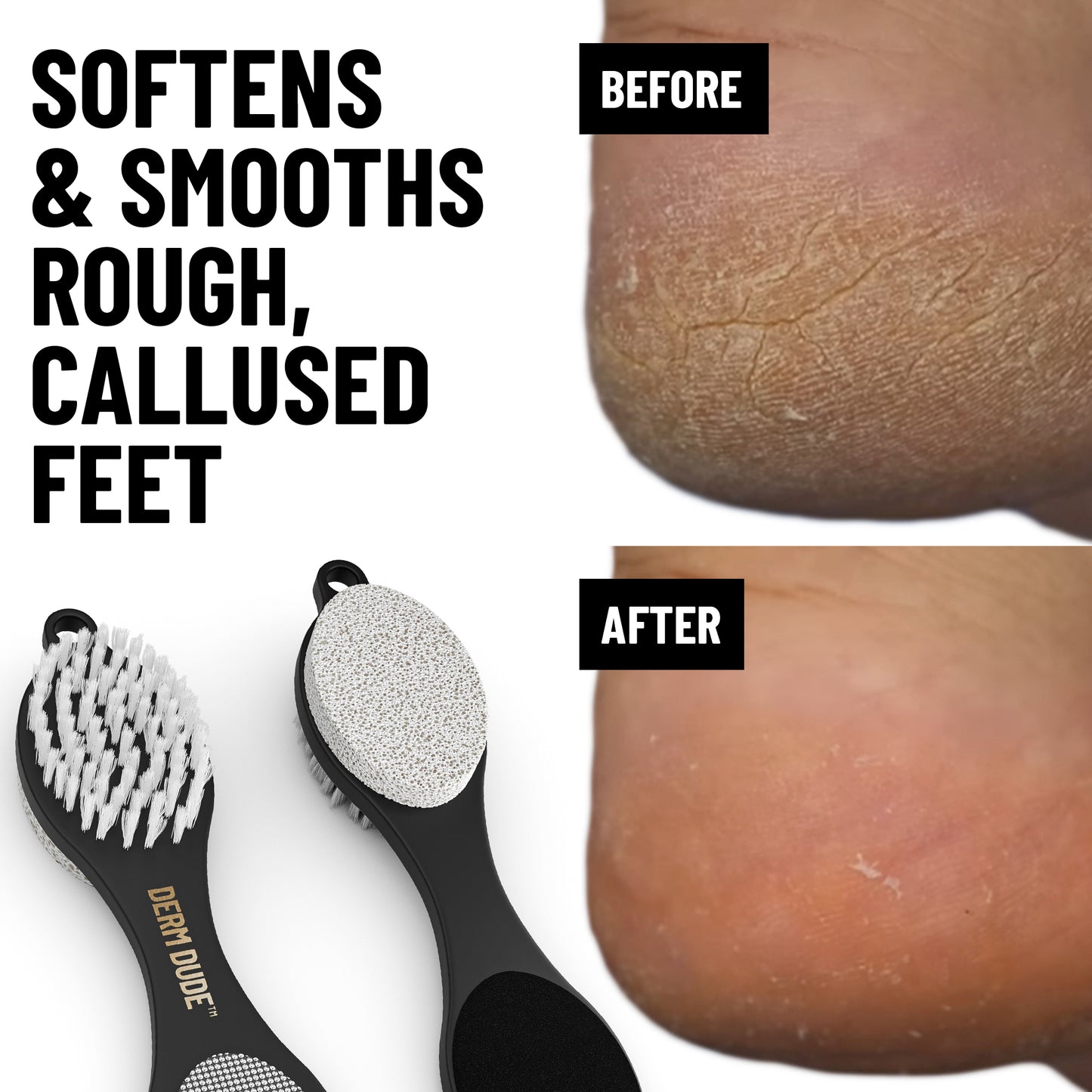 Foot File & Heel Repair Tool