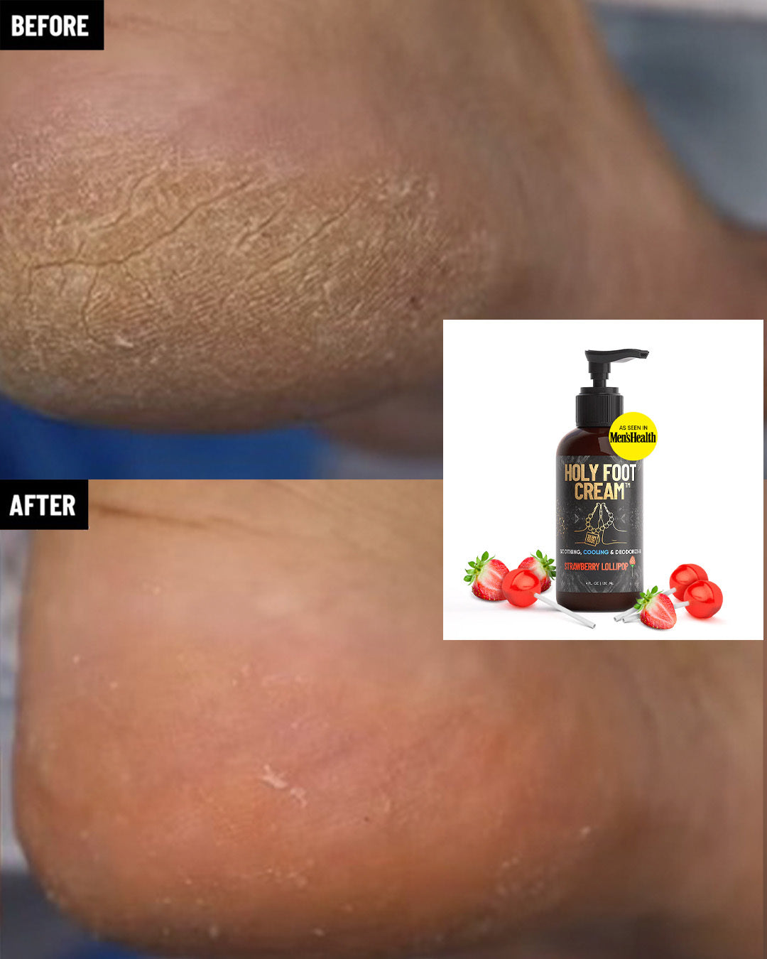 What Does Foot Cream Do: Foot Care Benefits