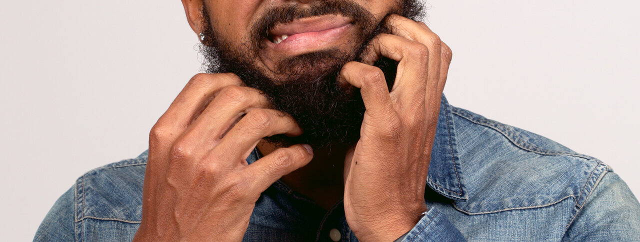 What Is Beard Druff? (Beard Dandruff)