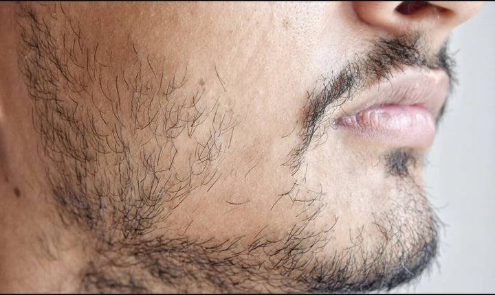 8 Tips to Prevent Patchy and Uneven Beard Growth