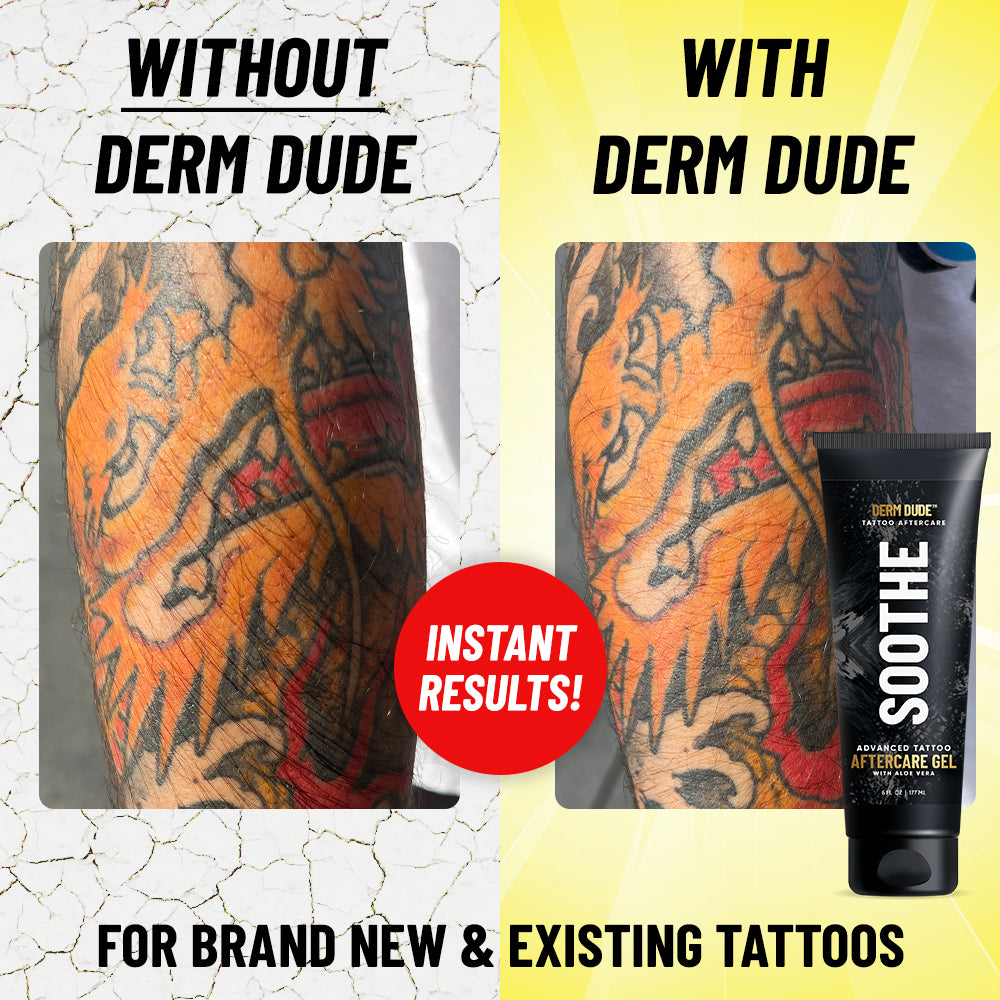 Tattoo Gel Aftercare | Tattoo Soothing Gel | Derm Dude