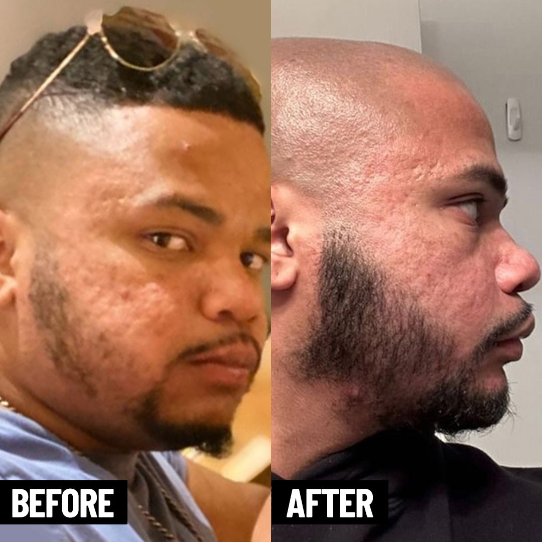 Daily Care Beard Set