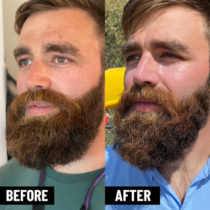 Accelerator Beard Oil