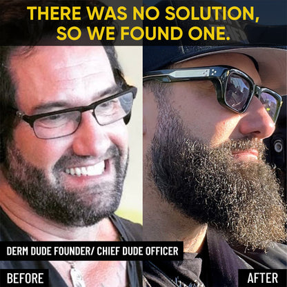 Mega Beard Growth Oil