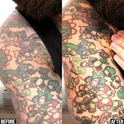Brighten and Protect Tattoo Set Derm Dude
